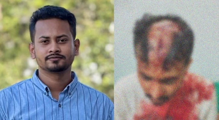 ‘আমি তো কোথাও ছিলাম না, আমার অপরাধ কী?’: নজরুল বিশ্ববিদ্যালয়ে সংঘর্ষে আহত শিক্ষার্থী